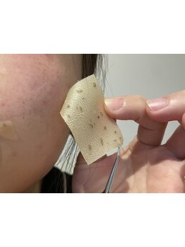 お肌をきれいにしたい