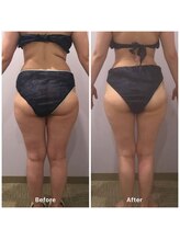 ナレル(narrel)/(新潟市/骨盤/痩身/ダイエット)