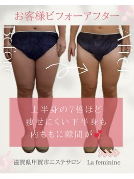 ラ フェミニン(La feminine)/20代モニター様☆下半身10回