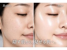 フジモトサロン 那覇おもろまち店(fujimotoサロン)の雰囲気（那覇/シミ/毛穴/アマラローマ/全身脱毛/脱毛/ピーリング/ハーブ）