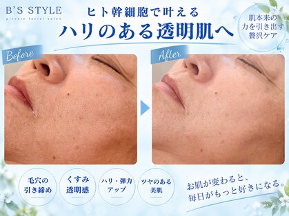 ビーズスタイル(B’S STYLE)の写真