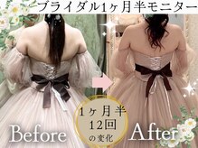 スリムプロ 天王寺店(Slimpro)/ブライダルエステ☆