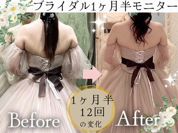 スリムプロ 天王寺店(Slimpro)/ブライダルエステ☆