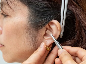 ナチュールフィット 宝塚店(Natur Fit)の写真/【結果重視!!】何をしても痩せなかった方に◎お客様に合わせた耳つぼ施術×食事指導で憧れの美ボディに☆