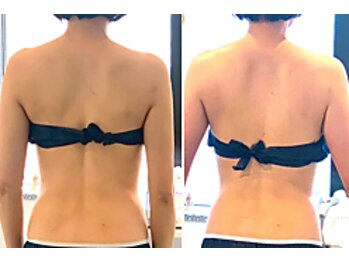 カリド ラボ(CALIDO LAB)/インディバ＆リンパ　全身120分