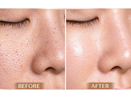 マロン(MARON)の写真