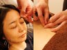 お顔のむくみや体のコリ疲労を全身鍼で一緒にスッキリ☆美容鍼×全身鍼プラン