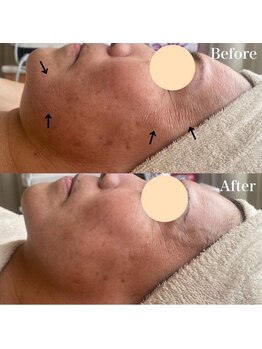 ドゥクス 難波店(Dux)/マーメイドセルトリートメント