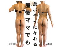 リノア(Lino'aka)の雰囲気（なんと一台五役！最新の本格痩身マシンは本気のダイエットに）