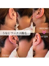 ココカナ(COCOKANA)/うなじMIX脱毛