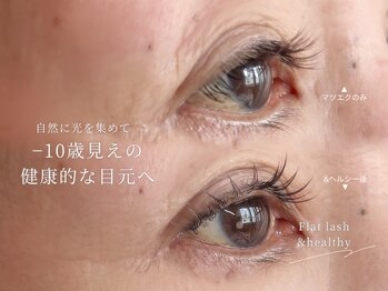 ロイル コア ビューティー(Loeyle core beauty)/下がりまつ毛悩み解消