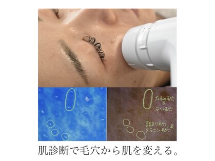 ステラ(Stella)の写真