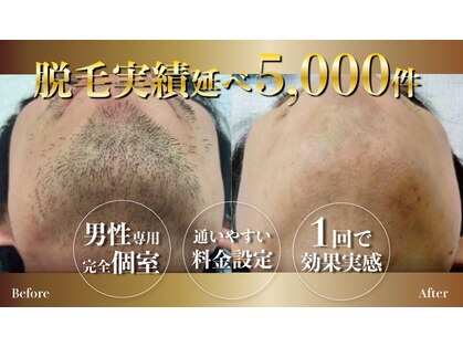 男前脱毛 菰野店の写真