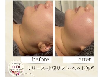 パーソナル ユニ(uni)/フェイスラインスッキリ小顔に!