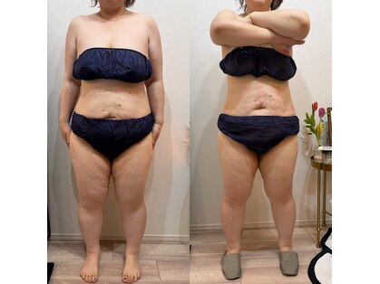 ヒメ ビューティー(Hime beauty)の写真