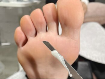 ル ネイル 天神店(Le nail)/フット角質ケア60分