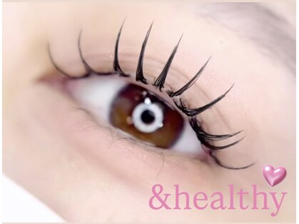 ボス(VOSS)の写真