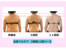 ユルポ(YuREPOS)/30代｜継続での変化