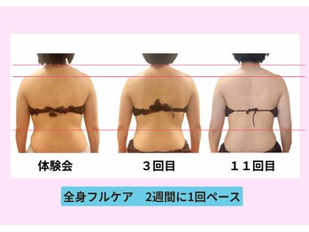 ユルポ(YuREPOS)/30代｜継続での変化