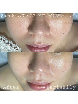 パリスエリー(PARIS ELLY)/顔ワックス☆光フェイシャル