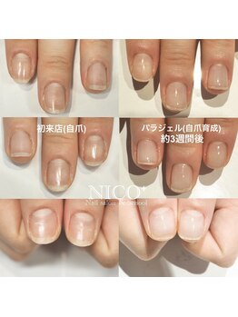ニコプラス(NICO+)/自爪育成中