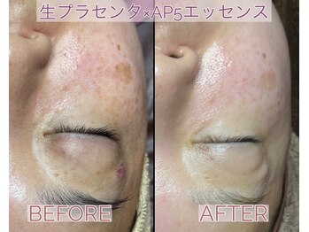 シストワ(sistoi)/驚異的♪Before★After☆