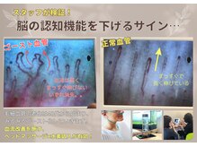 ユトレ(yutre)/水素吸入で健康な血管を取り戻す