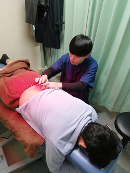 東陽町駅前たけだ整骨院 鍼灸院 整体院/鍼の施術