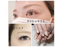 アレーズ(alaise)
