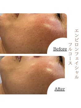 ソワ 恵比寿(soi)/エンビロンフルコース