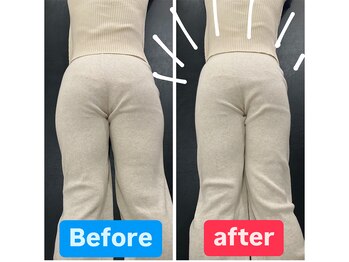 ナオル整体 兵庫院(NAORU整体)/小尻矯正のBeforeAfter