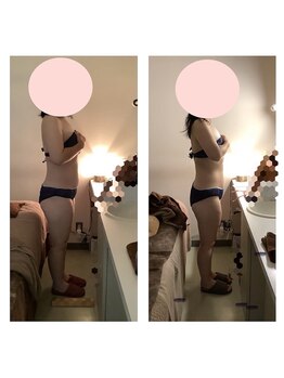 アクア エステティコ 亀有(ACQUA estetico)/40代　痩身　上半身