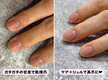ココネイル(coco.nail)/気になる甘皮、縦筋をケアします