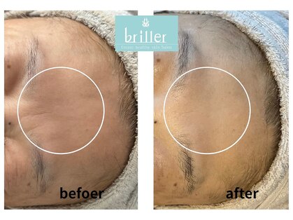 ブリエ 自由が丘(briller)の写真