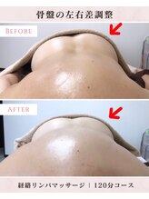 鍼灸院ハリーユ(HARIeyu)/【骨盤の傾きの変化】