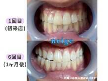 ネージュ(neige)/30代後半/男性/コーヒー1日2杯