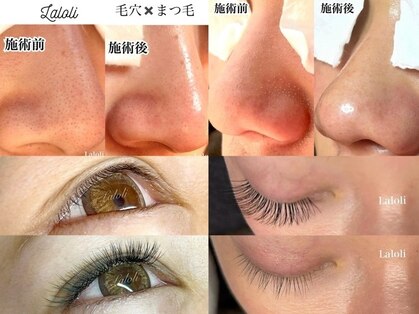 ラロリ(Laloli)の写真