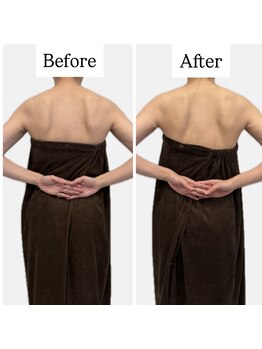 ラヴィ(Ravi)/背中美人コース60分