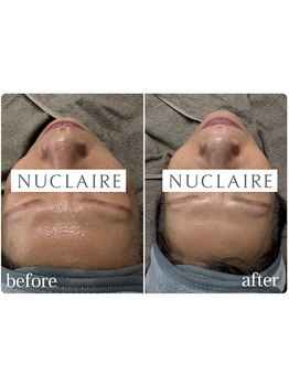 【フェイシャルワックス専門店】 Ncrear 【エヌクレアール】/