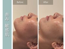 ジョルネ 中目黒(jornee.)の雰囲気（お肌の構造を捉えたピーリングで肌質改善♪［ハーブピーリング］）