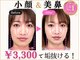 隆鼻矯正専門店 ラプリ(Raplit)の写真