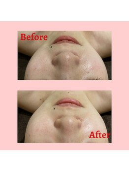 グロウ トータルビューティデザイン(GLOW TOTAL BEAUTY DESIGN)/クリスタルパック