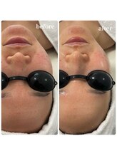 リアム(LiAm)/トーンアップ &nbsp;ララピール