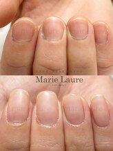 マリーロール 梅田店(Marie Laure)/深爪矯正/自爪育成/自爪風