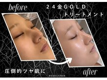 アメリオレ 国分寺店(AMELIORER)/刺激なく手触り感動のツヤ肌へ！