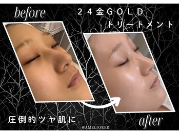 アメリオレ 国分寺店(AMELIORER)/刺激なく手触り感動のツヤ肌へ！