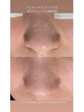 美顔秘密基地 新宮/スペシャル艶肌コース♪