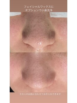 美顔秘密基地 新宮/スペシャル艶肌コース♪