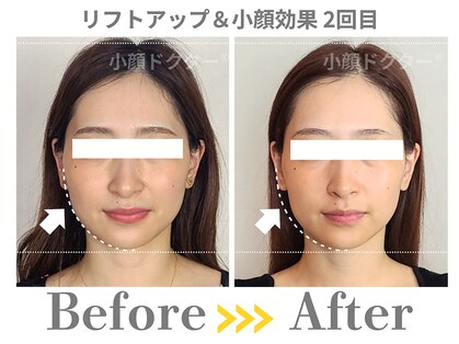 小顔ドクターの写真