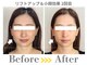 小顔ドクターの写真